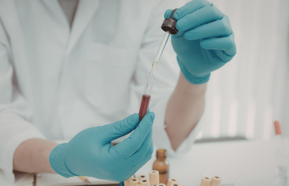 Hisztamin intolerancia kivizsgálása